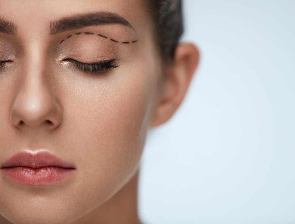 Plastic Surgery Operation. Woman Face With Black Surgical LinesBlépharoplastie, chirurgie des paupières - Chirugie esthétique et plastique à Paris et Boulogne - Dr Staub